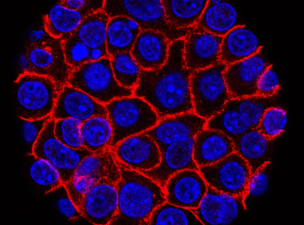 Foto: Eli and Edythe Broad Center for Regenerative Medicine and Stem Cell Research at USC, USC Norris Comprehensive Cancer Center, File/Min Yu